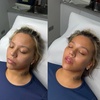 Image 8: Revitalize with 20, 40, or 60 Units of Botox for a Smooth Look