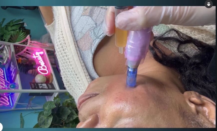 Image 1: Up to 63% Off on Micro-Needling at Aesthetics Care Med Spa