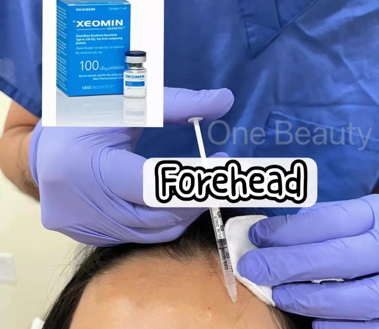 Xeomin Sessions at One Beauty Aesthetics (Up To 54% Off) - Second Medium