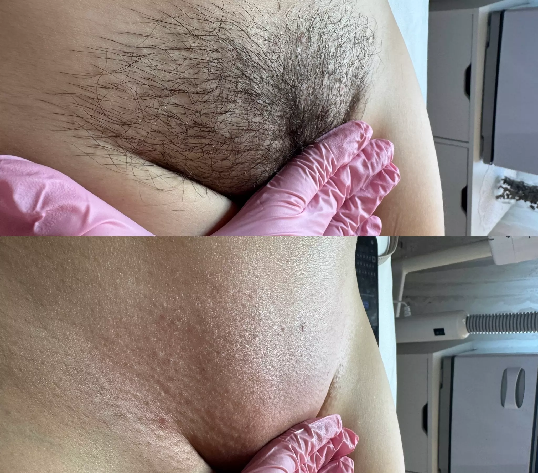 Achieve Silky Smooth Skin with Brazilian & Bikini Waxing at Beloved esthetics(Up To 38% Off) - Second Medium