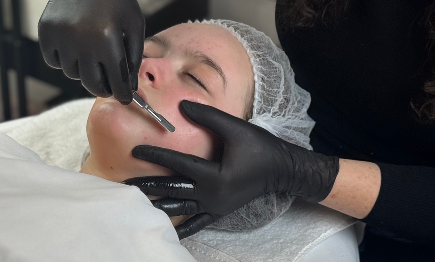 Image 1: Up to 50% Off on at Skin Loft Aesthetics