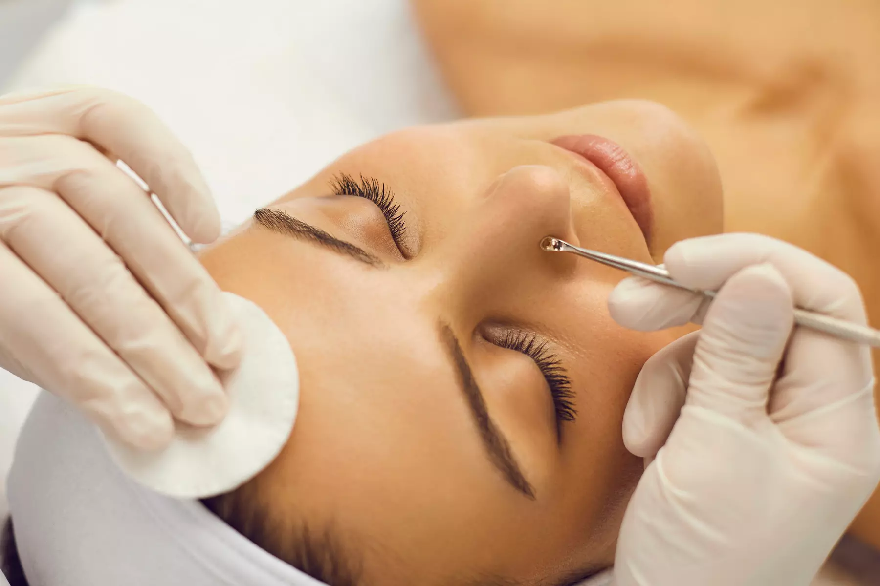 Up to 46% Off on Deep Pore Cleansing Acne Facial at Skincare By Mercedes - Primary Image