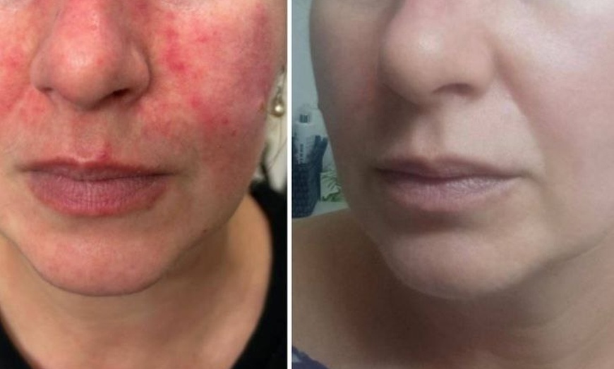 Image 3: Bis zu 56% Rabatt auf den Kosmetische Gesichtsbehandlung bei Gym for skin Kosmetiksalon