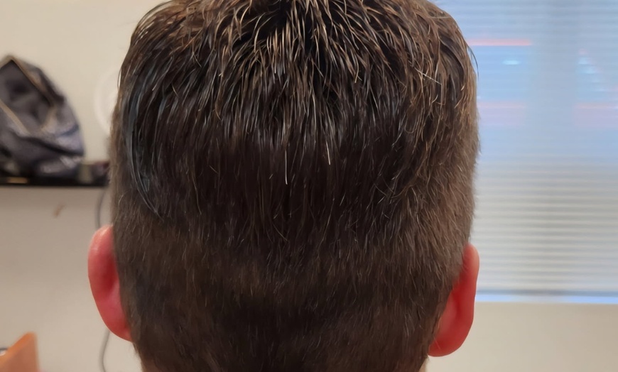 Image 4: $369 or $265 Worth of Non Surgical Hair Replacement