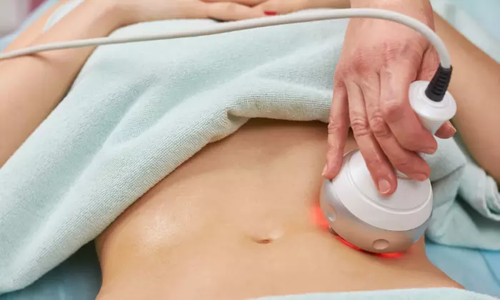 Experience Luxe Salon and Spa Pearland's radio frequency body skin tightening for one or two areas, up to 40% off - Primary Image