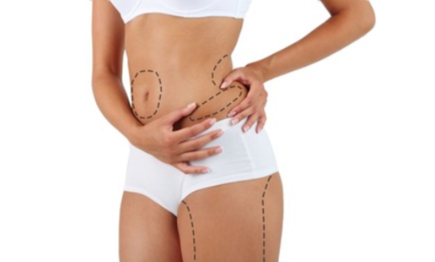 Image 1: Fat Dissolving: Target Medium/Large Areas with Optional Anti-Cellulite