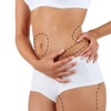 Image 1: Fat Dissolving: Target Medium/Large Areas with Optional Anti-Cellulite
