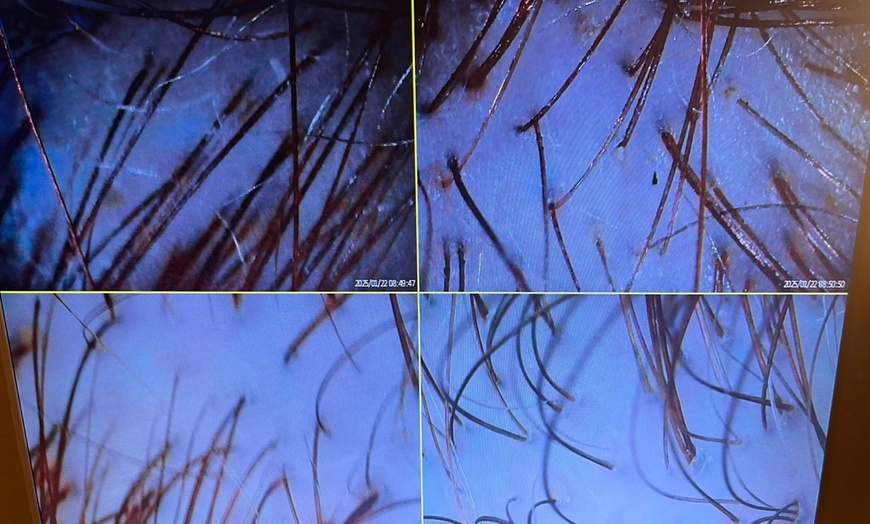 Image 8: Up to 45% Off on Salon - Scalp Care at Luz Spa Studio