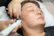 Up to 84% Off on HydraFacial at Magic Beauty Wellness - Second Medium