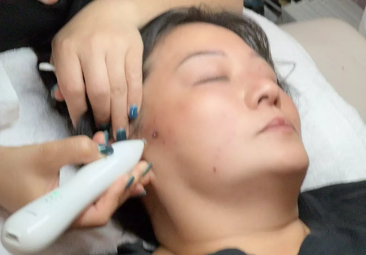 Up to 60% Off on HydraFacial at Magic Beauty Wellness - Second Medium