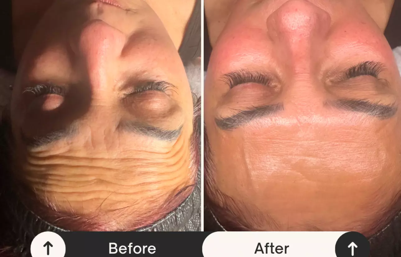 Up to 55% Off on Facial at Bellissima Spa - Primary Image