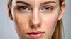 Revitalize Your Skin: 1 or 3 IPL Photofacials Sessions at Bye 2 Hair LLC (Up To 47% Off)