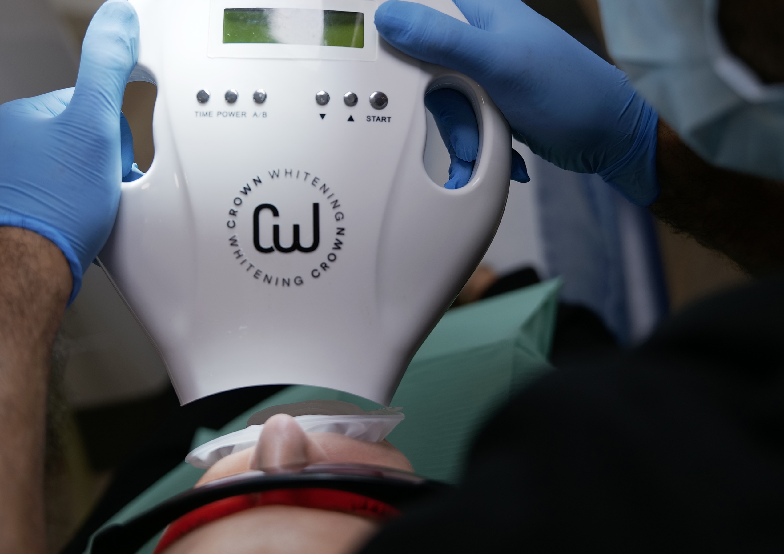 Green Dental Ltd Offers Laser Teeth Whitening + Philip Zoom or Crown System With or Without Consultation