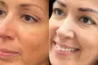 Up to 50% Off on Microblading at SkinFit by Anneliese - Second Medium