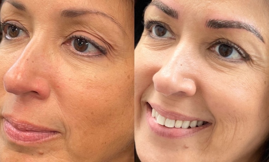 Image 4: Up to 55% Off on Microblading at SkinFit by Anneliese