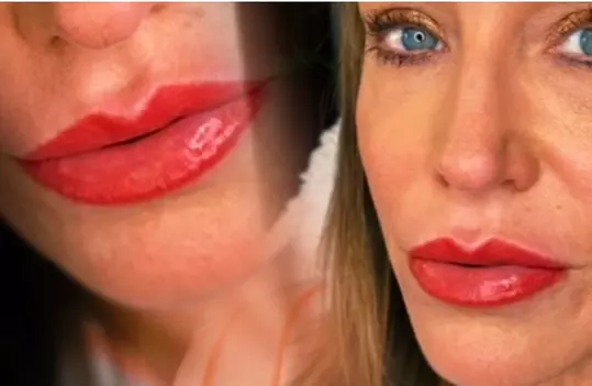 Enhance Your Lips & Transform Your Look with Our Lip Blushing Service