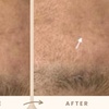 Image 5: Reverse Ageing & Repair Scars: Sylfirm X (One, Two, or Three Sessions)