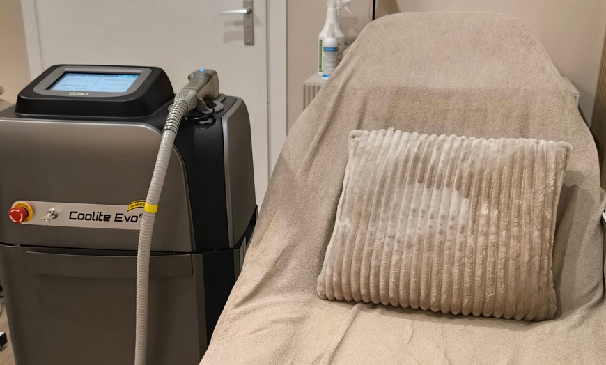 Image 3: Depilacja laserowa wybranych obszarów