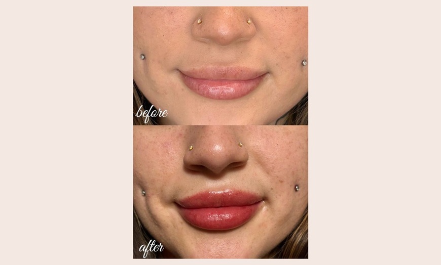 Image 5: Defined Brows & Lips with Microblading or Lip Blush