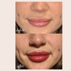 Image 5: Defined Brows & Lips with Microblading or Lip Blush