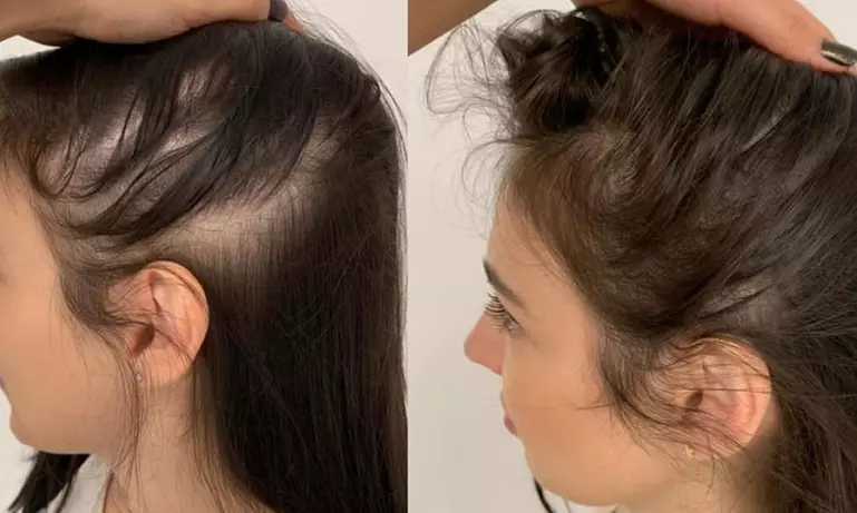 Up to 67% Off on Salon - Hair Straightening Treatment at UK Aesthetics Lounge