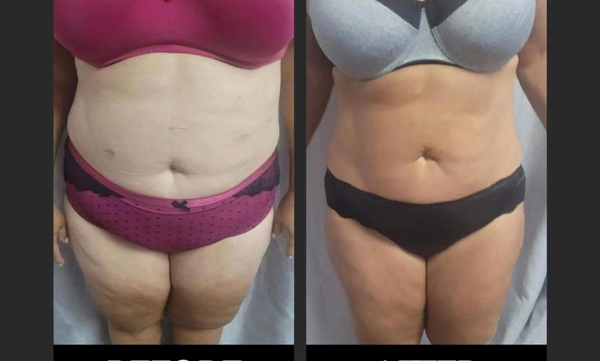 Image 4: One 30-Min EMS Body Contouring session on the Abdomen or on the Glute