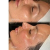Image 4: Up to 55% Off on Spa / Salon Beauty Treatments at Oh my glow llc