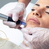 Image 1: 3-in-1 Advanced Microneedling with TCM Botanical Serums + LED Therapy