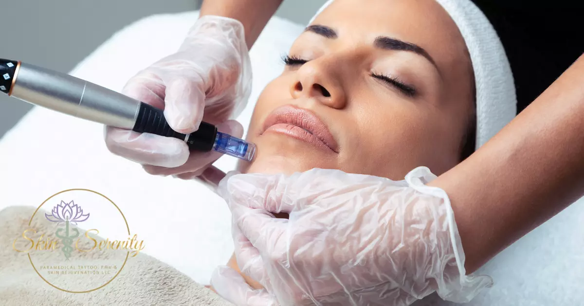 3-in-1 Advanced Microneedling with TCM 
Botanical Serums + LED Therapy