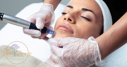 Basic Micro-Needling Session with Hyaluronic Acid - Skin Serenity