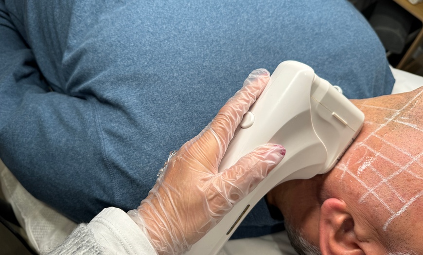 Image 2: Revitalize Your Look with 8D HIFU for Face, Neck, Chin, Jawline and Jowls at NuSkin Beauty (Up to 50% Off)