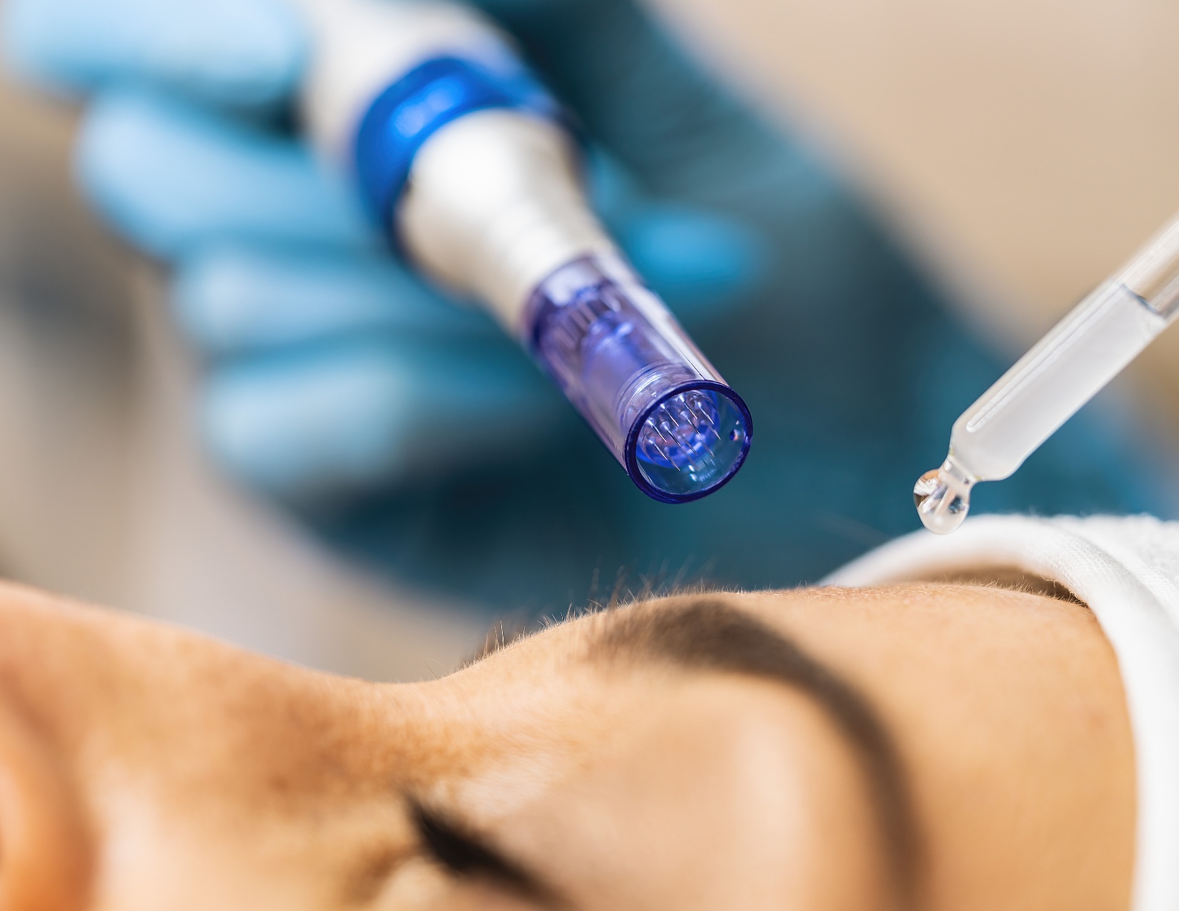 Up to 50% Off on Micro-Needling at Pynkberry Aesthetics