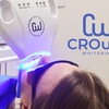 Image 4: Get a Brighter Smile in One Hour with Teeth Whitening, Consultation and Optional Whitening Kit (Up to 52% Off)