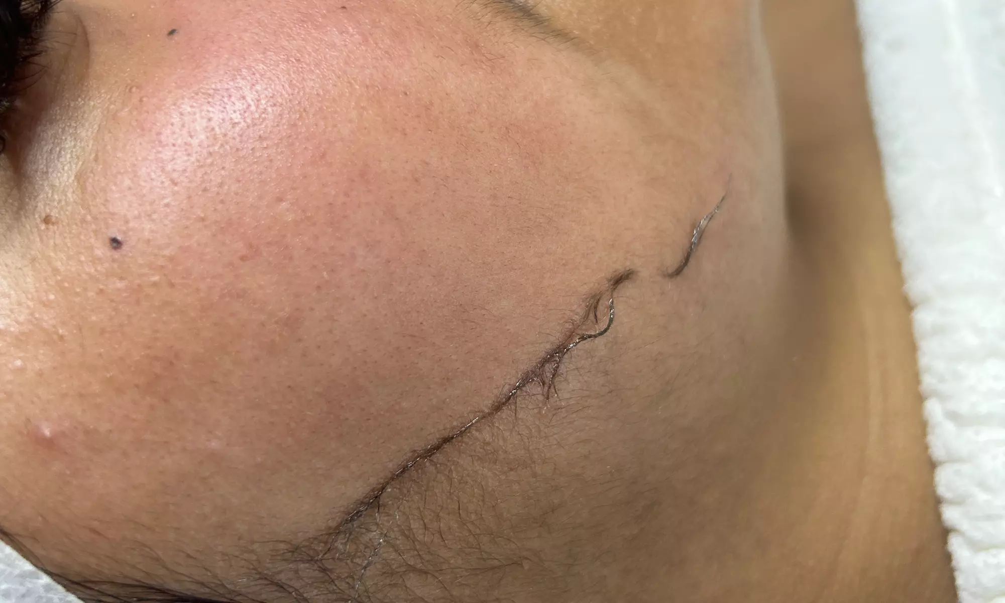 Enjoy a 60-Minute Exfoliating Facial for a Radiant Glow