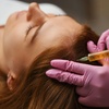 Image 1: Revitalize with PRP: One or Three Sessions for Skin & Hair Treatment
