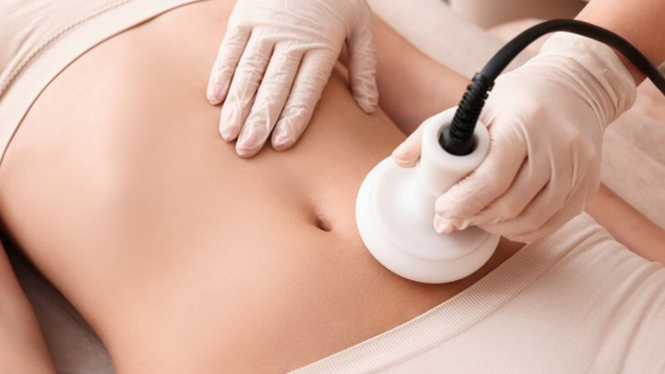 Ultrasonic Cavitation or Radio Frequency Sessions