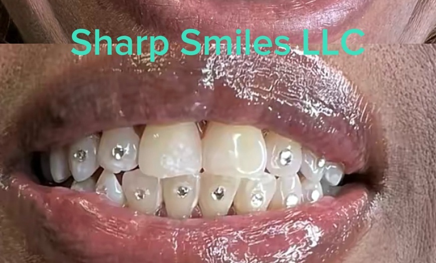Image 3: Brighten Your Smile With Teeth Whitening, Polishing & More 