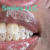 Image 3: Brighten Your Smile With Teeth Whitening, Polishing & More 