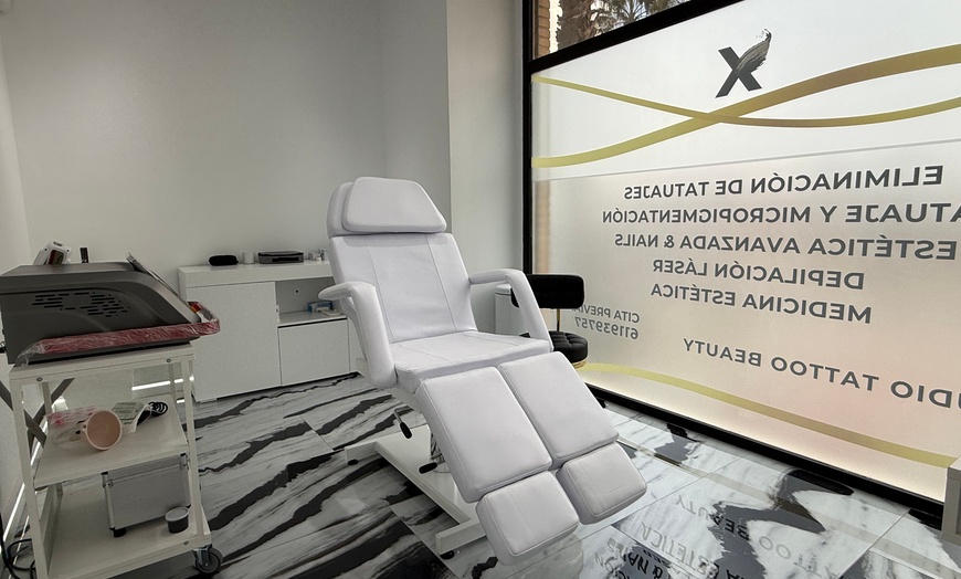 Image 5: 3 o 6 sesiones de eliminación de tatuaje de hasta 10 x 10 cm para 1