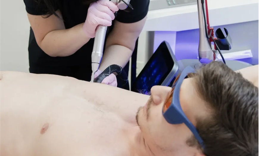 Image 1: Achieve Ink-Free Skin with Laser by Nicole's Tattoo Removal for All Sizes up to 39%