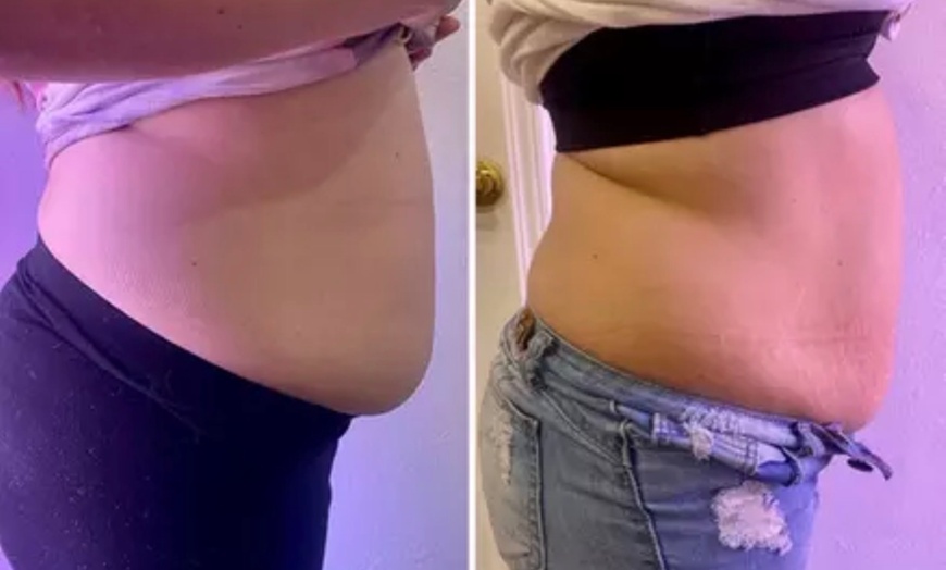 Image 2: Up to 62% Off on Fat Reduction - Non-Branded at Beauty By Bear