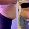 Image 2: Up to 62% Off on Fat Reduction - Non-Branded at Beauty By Bear