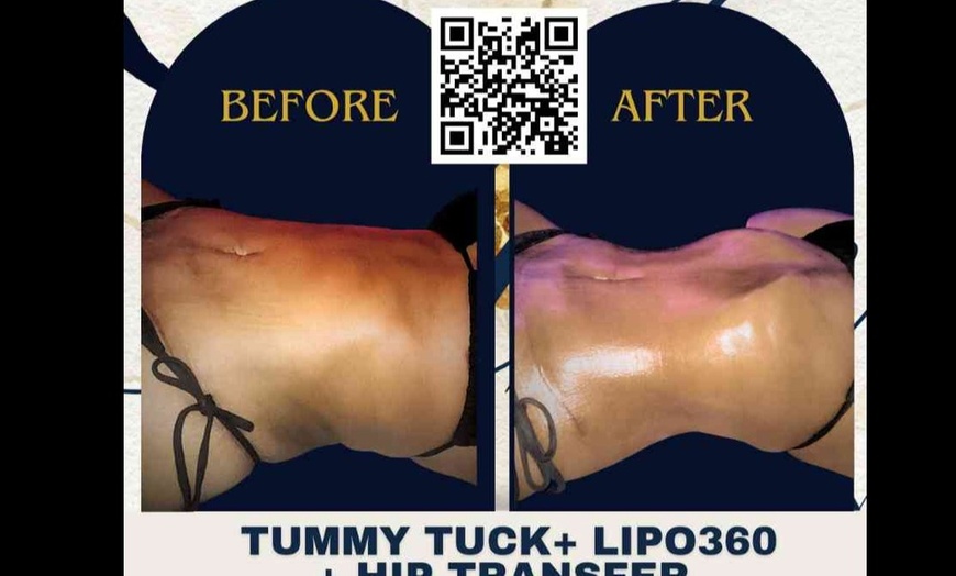 Image 3: Cosmetic Surgery Aftercare 1 2 Or 3 Packs of 30-Min Recovery Treatment