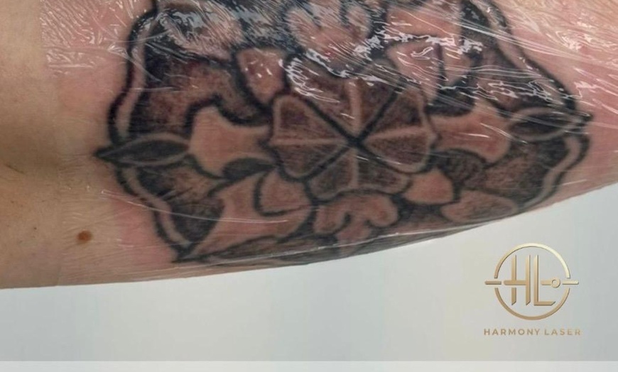 Image 5: Up to 68% Off on Tattoo Removal at HL Lasers