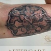 Image 5: Up to 68% Off on Tattoo Removal at HL Lasers