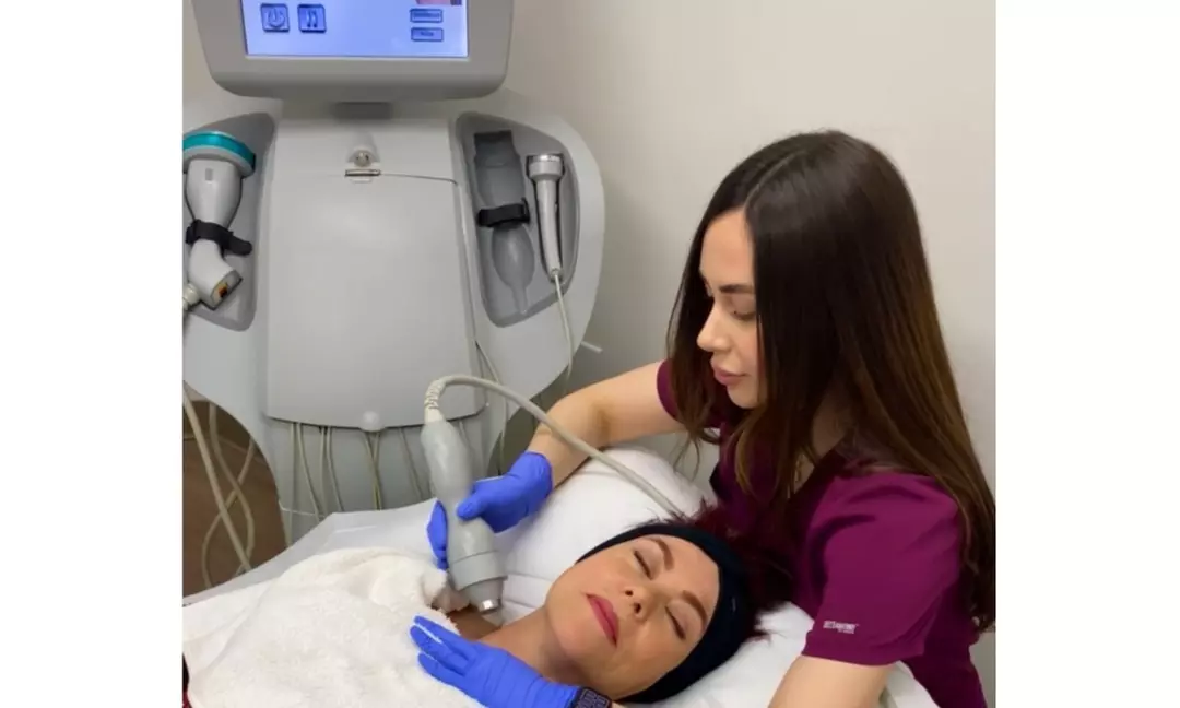 Non-surgical ThermaLift skin tightening facelifts for youthful glow