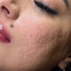 Image 4: One Permanent Eyebrow, Eyeliner or Lip Blushing Tattoo Sessions

