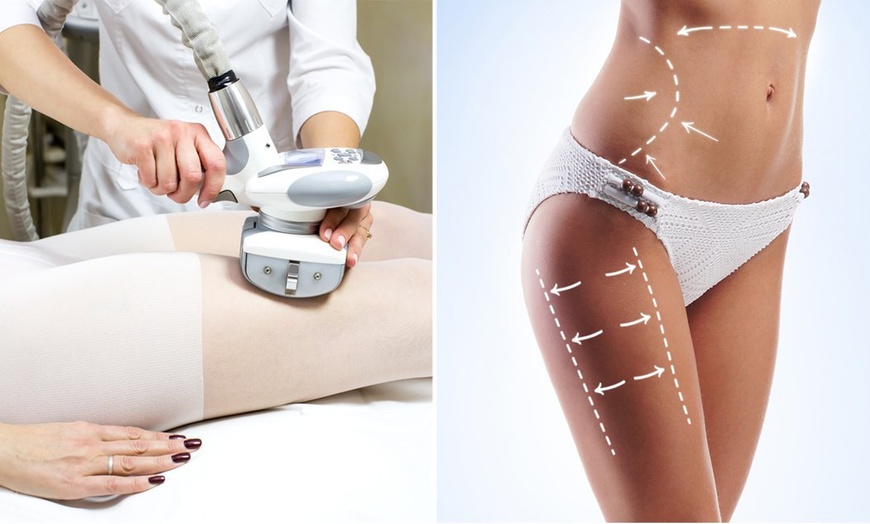 Image 1: Sculpt Your Body: Endermologie Body Shaping and Firming Treatment