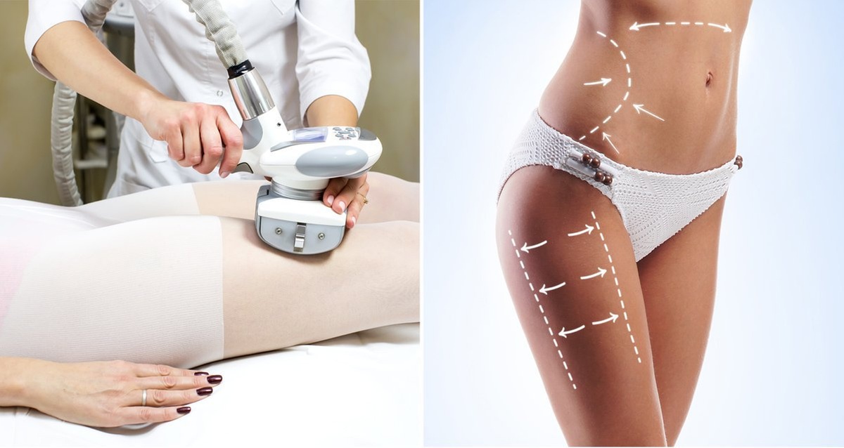 Sculpt Your Body: Endermologie Body Shaping and Firming Treatment
