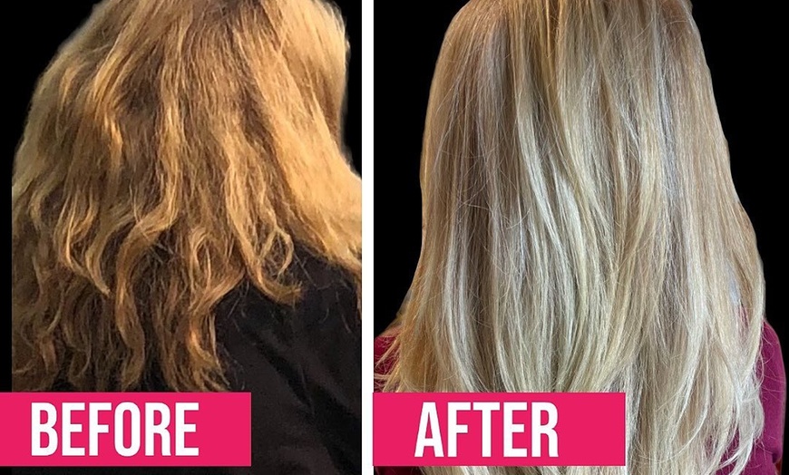 Image 3: Boost Hair Health with Scalp Care Consultation! 